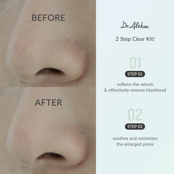 Dr. Althea Blackhead Zero 2 Step Nose Patch