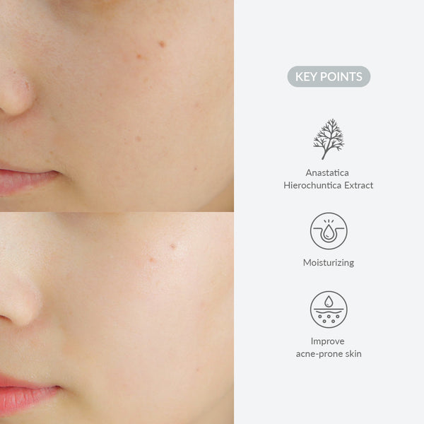 Dr. Althea Last Minute Skin Rescue Anastatica Mask