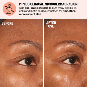 Dr. Brandt Skincare Advanced Face Exfoliator