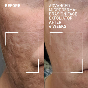Dr. Brandt Skincare Advanced Face Exfoliator