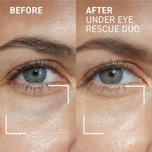 Dr. Brandt Skincare Eye Puffiness & Fatigue Duo