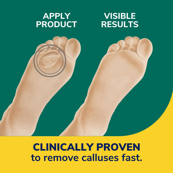 Dr. Scholls Callus Removers Seal & Heal Bandage With Hydrogel Technology