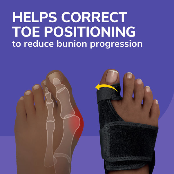 Dr. Scholls Bunion Relief & Toe Corrector
