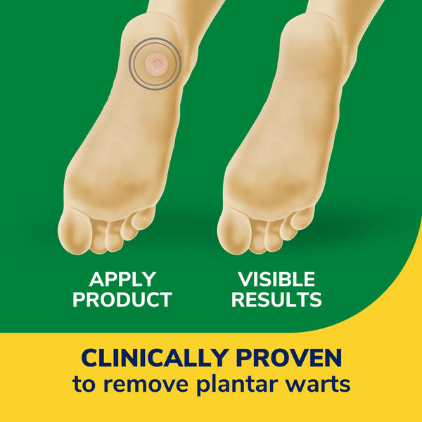 Dr. Scholls Clear Away® Plantar Wart Removers