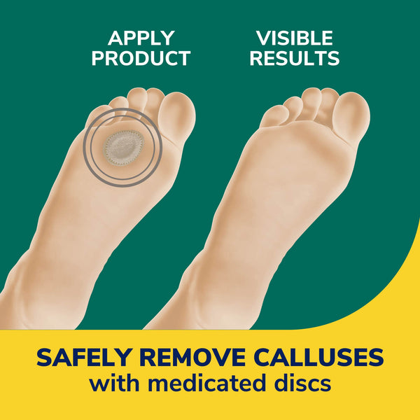 Dr. Scholls Extra Thick Callus Removers