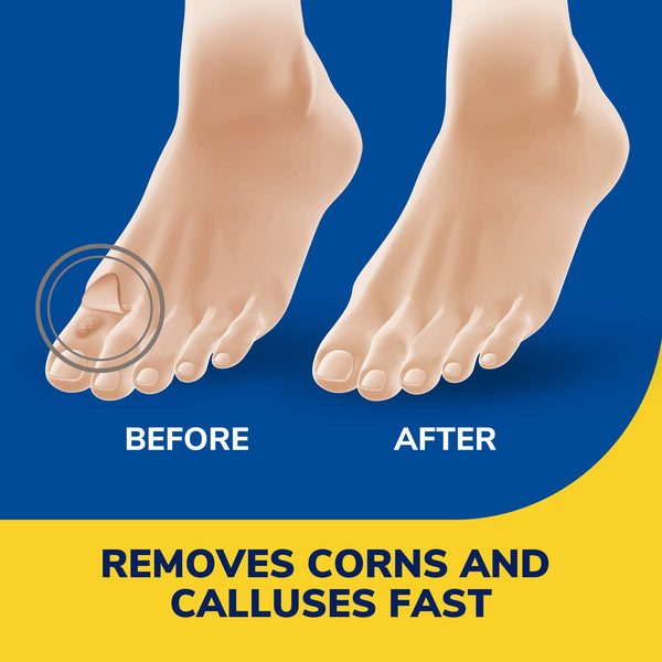 Dr. Scholls Liquid Corn & Callus Remover