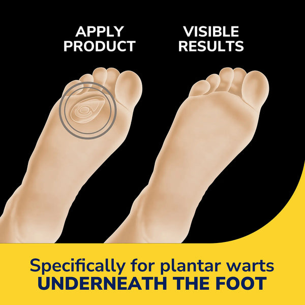 Dr. Scholls Plantar Wart Remover Seal & Heal Bandage With Hydrogel Technology