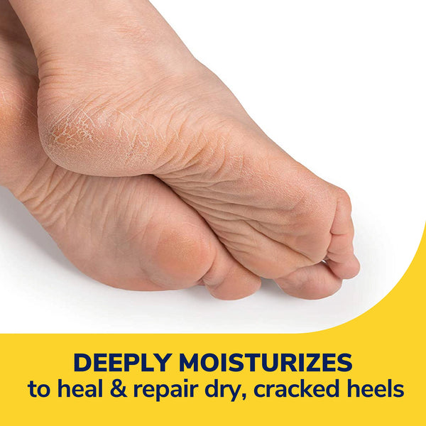Dr. Scholls Severe Cracked Heel Repair Restoring Balm