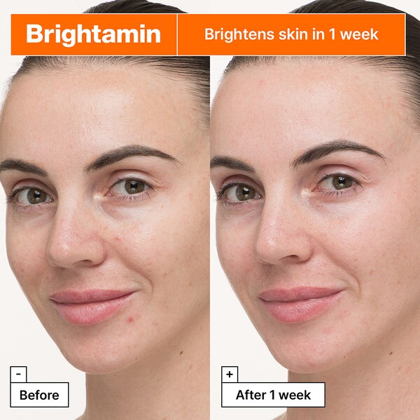 Dr.jart Brightamin Brightening Serum With Niacinamide And Vitamin C