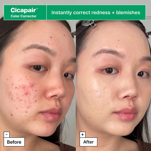 Dr.jart Cicapair™ Redness Rescue Regimen Kit With Centella Asiatica