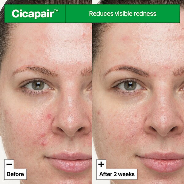 Dr.jart Cicapair™ So Soothing Treatment For Visibly Irritated Skin