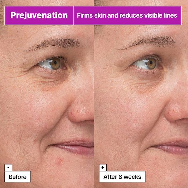 Dr.jart Prejuvenation Firming Bakuchiol Serum For Preventative Aging