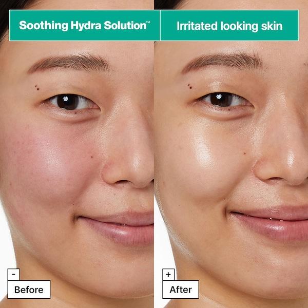 Dr.jart Soothing Hydra Solution™ PRO Face Mask For Irritated Skin 5 Pack