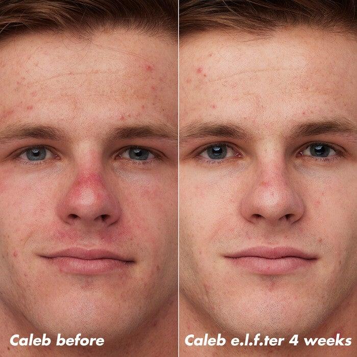 E.l.f. Cosmetics PLZ Clarify Facial Oil