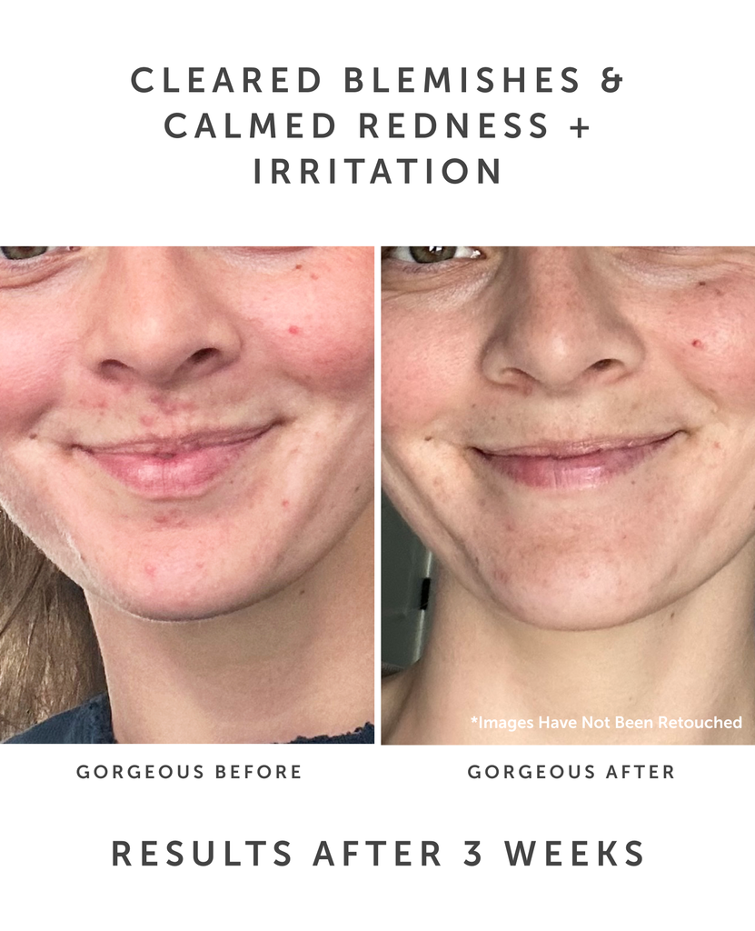 Earth Harbor SAMPHIRE Biotic Perfecting Serum