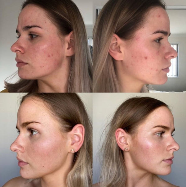 Eco By Sonya 3 Step Skincare System With Acai Exfoliator