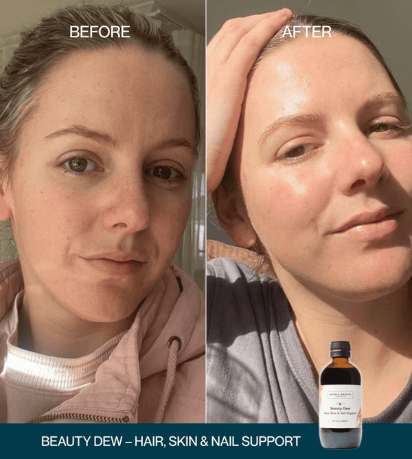 Edible Beauty Beauty Dew - Hair Skin & Nail Support