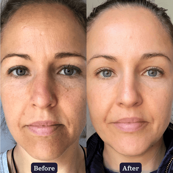 Edible Beauty Inside Out Collagen Boosting Duo