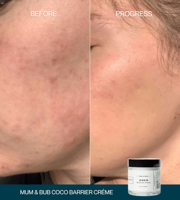 Edible Beauty Mum & Bub Coco Barrier Creme
