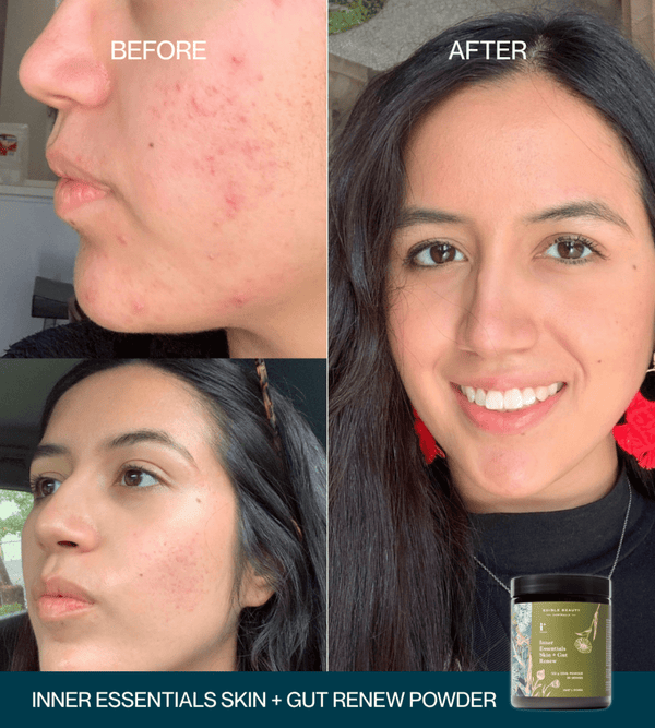 Edible Beauty Inner Essentials – Skin + Gut Renew Powder