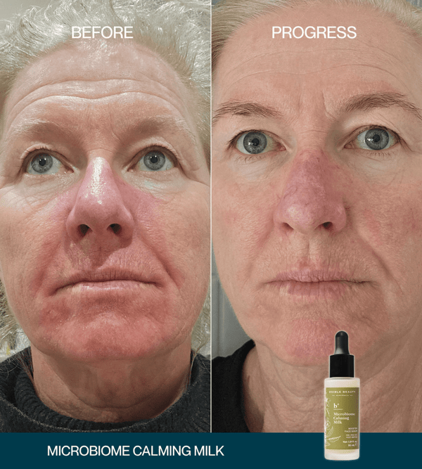 Edible Beauty Microbiome Calming Milk Booster Serum