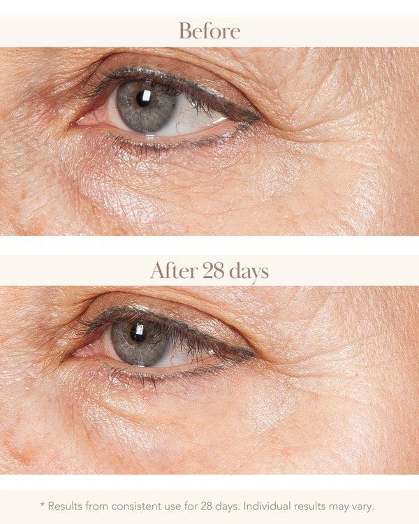 Elizabeth Grant Torricelumn Absolute Miracle 02 Eye Serum 30 Ml