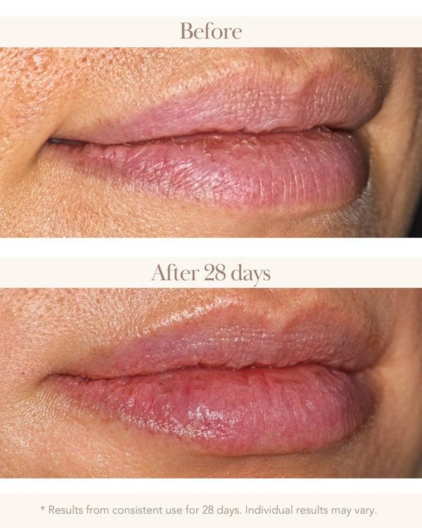 Elizabeth Grant Torricelumn Absolute Nourishing Lip Mask 20 Ml