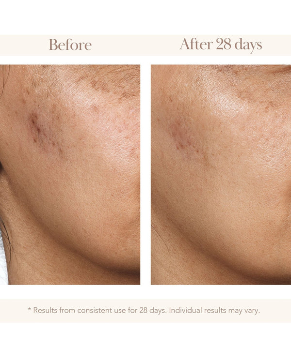 Elizabeth Grant Vitamin C Gold C Concentrate Serum 90 Ml