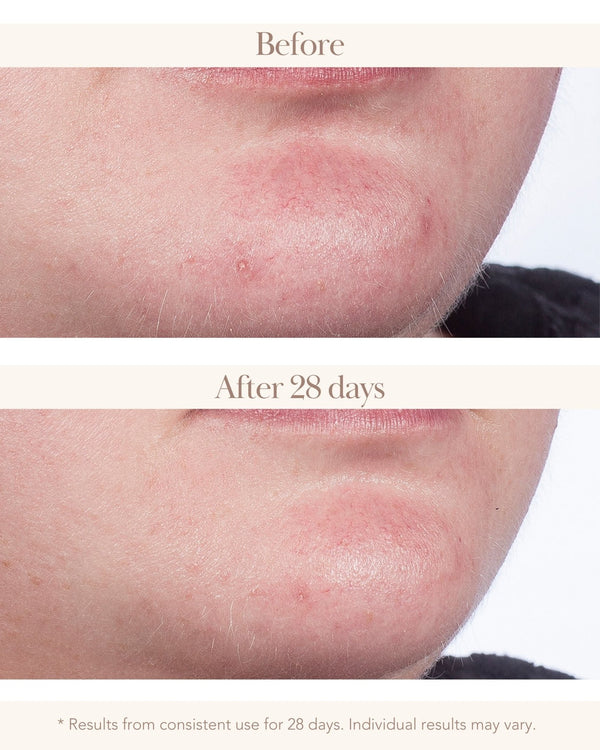 Elizabeth Grant Wonder Effect Advanced Retinol Night Cream 50 Ml