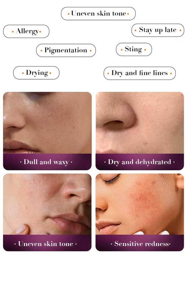 Elo Sadoer Snail Reorganize Collagen Lotion