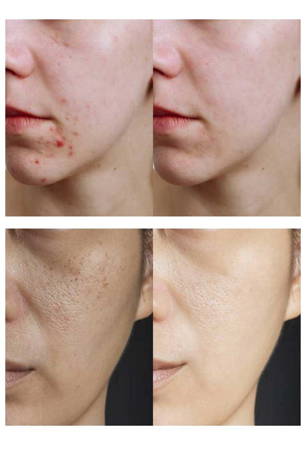 Elo Trillium Glutapure-C Skin Brightening Face Wash