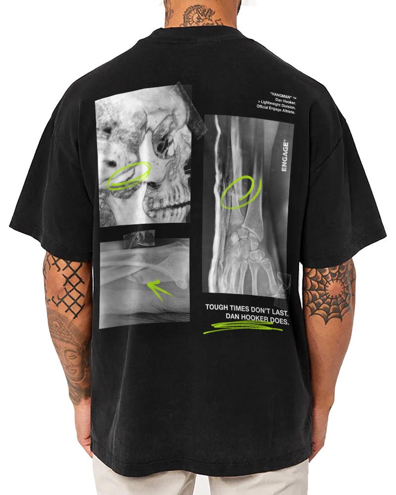 Engage Dan Hooker 'Just A Scratch' Oversized Supporter T-Shirt
