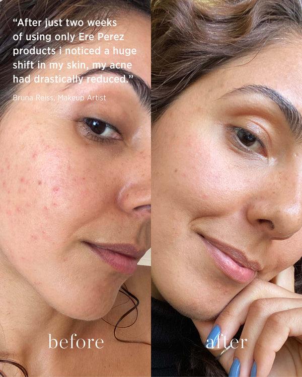 Ere Perez Clear Skin Set