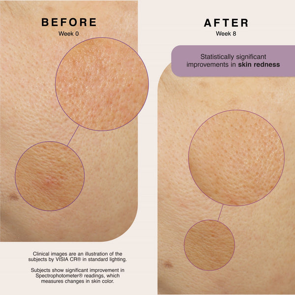 Erno Laszlo Soothing Relief Hydration Lotion