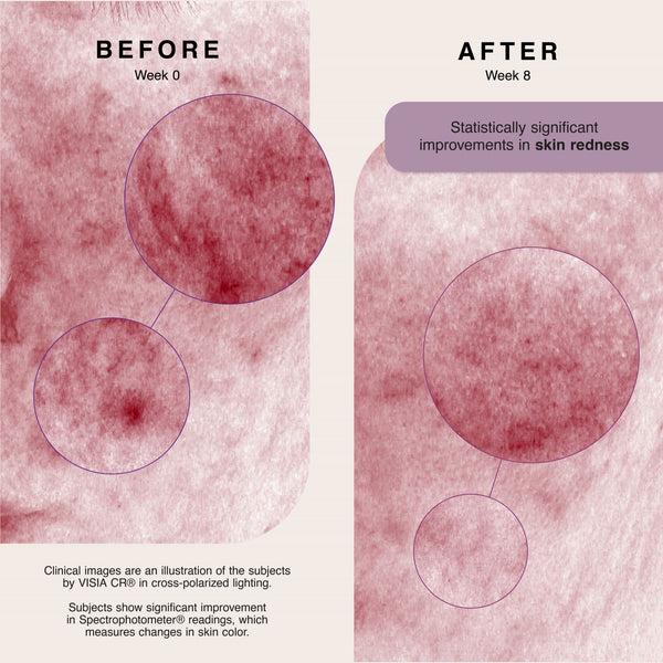 Erno Laszlo Soothing Relief Hydration Serum