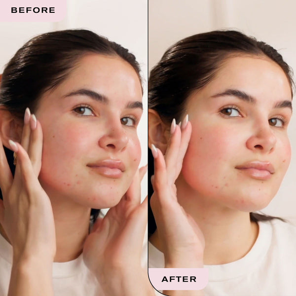 Erno Laszlo Vitality Treatment Mask