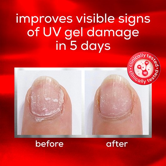 Essie To The Rescue UV Gel Damage Repair