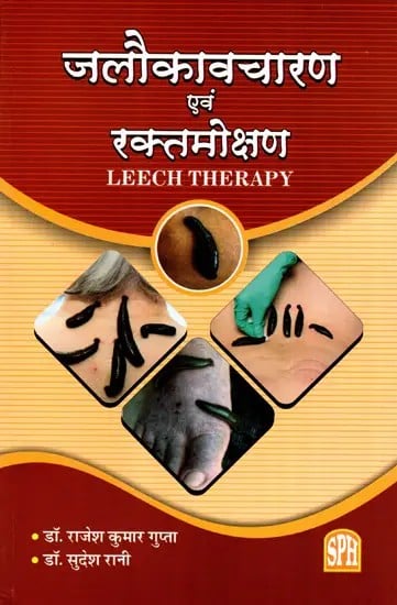 exotic india जलौकावचारण एवं रक्तमोक्षण: Jalaukavacharana and Raktamokshana- Leech Therapy 