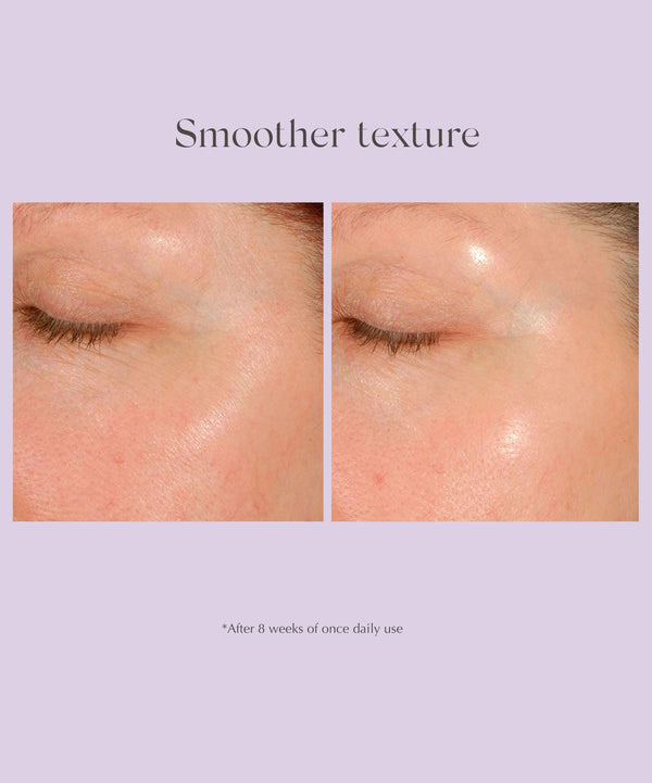 Exuviance Daily Resurfacing Peel CA¹⁰