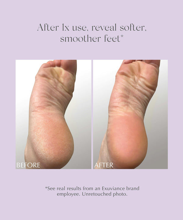 Exuviance Exfoliating & Conditioning Foot Balm
