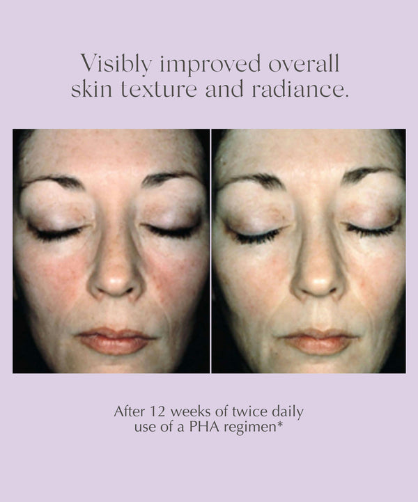 Exuviance Overnight Transformation Complex