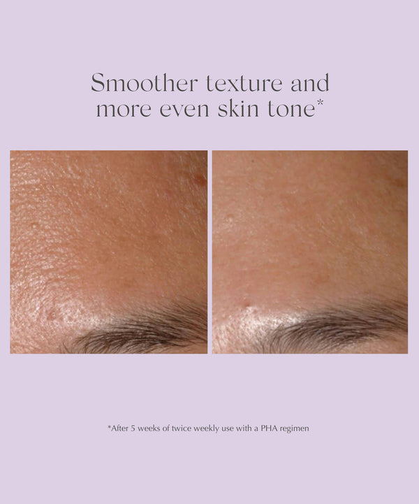 Exuviance Performance Peel AP25 At-Home Chemical Peel