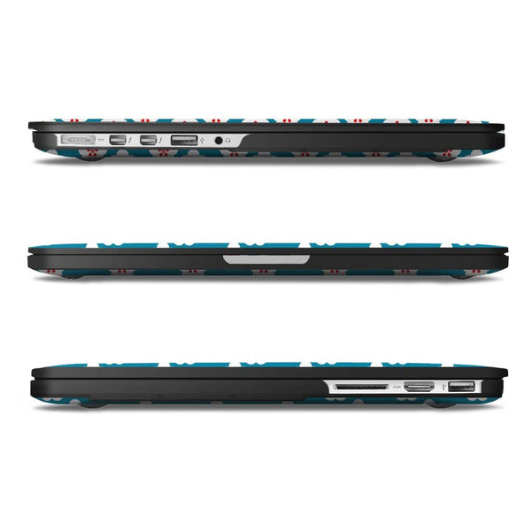 Fintie MacBook Pro 15 Retina (A1398) Hard Shell Case | Fintie
