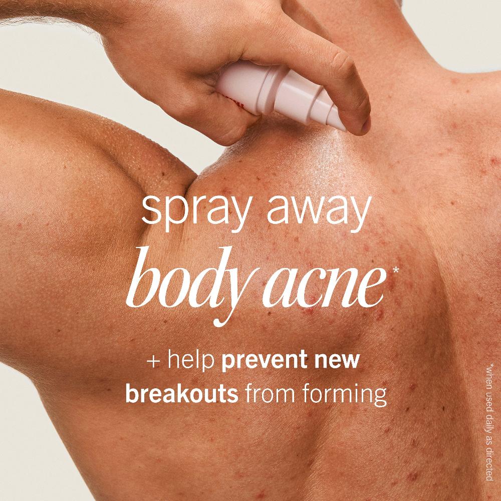 First Aid Beauty Body Acne Clearing Mist 2% Salicylic Acid Treatment