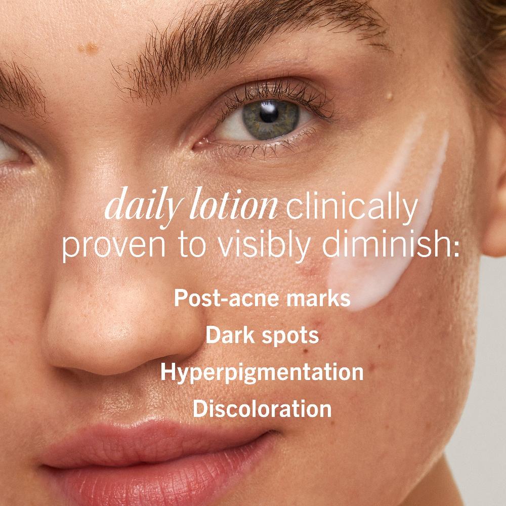 First Aid Beauty Daily Resurfacing Lotion With 2% Niacinamide Treatment