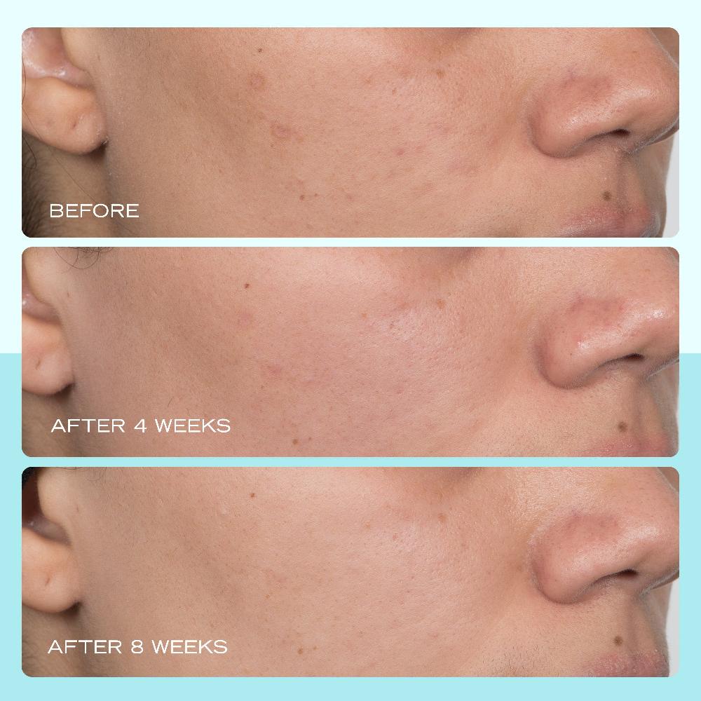 First Aid Beauty Dark Spot Serum With Niacinamide Serum