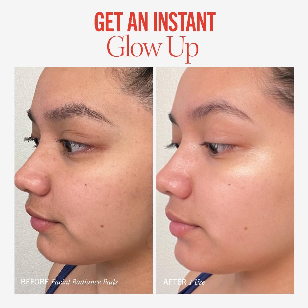 First Aid Beauty Facial Radiance Pads With Glycolic + Lactic Acids Travel Size Exfoliator