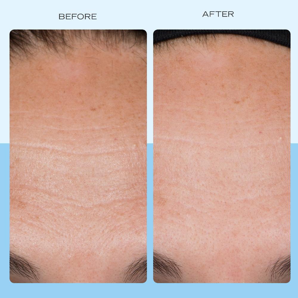First Aid Beauty Firming Cream With Peptides Niacinamide + Collagen Moisturizer
