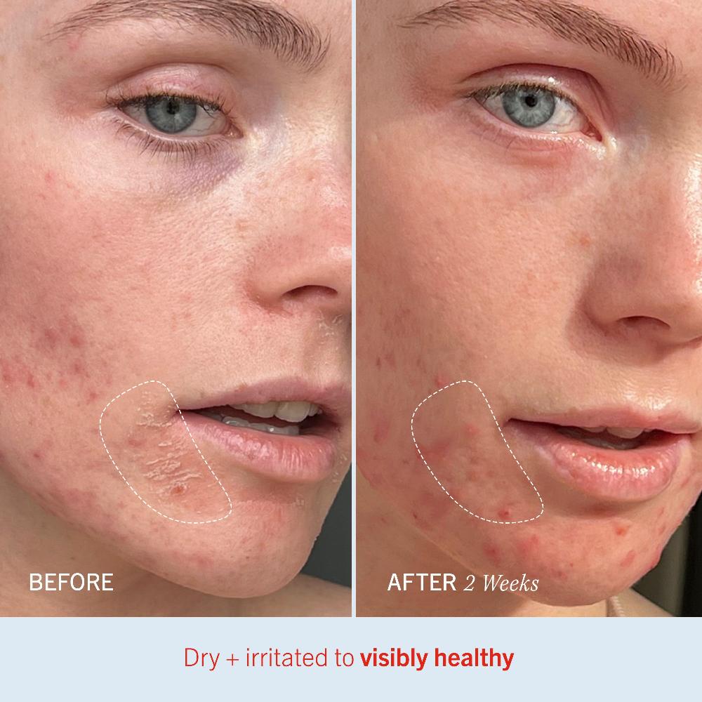 First Aid Beauty Dry Skin Duo Bundle