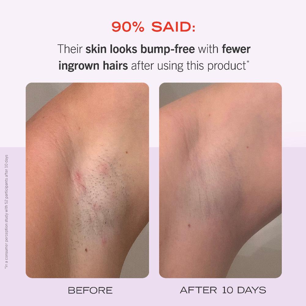 First Aid Beauty Ingrown Hair Pads With BHA + AHA Travel Size